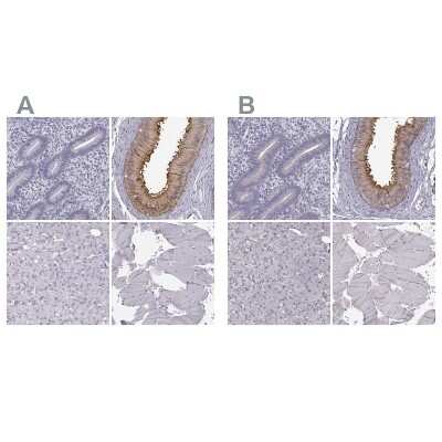 Immunohistochemistry-Paraffin: GPR64 Antibody [NBP2-55504]