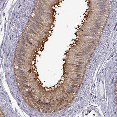 Immunohistochemistry-Paraffin: GPR64 Antibody [NBP2-55504]