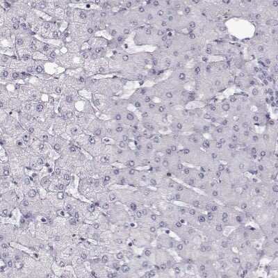 Immunohistochemistry-Paraffin: GPR64 Antibody [NBP2-55504]