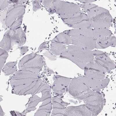 Immunohistochemistry-Paraffin: GPR64 Antibody [NBP2-55504]