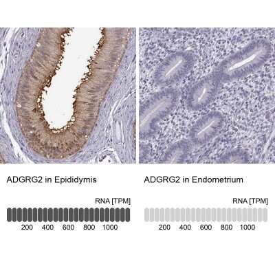 Immunohistochemistry-Paraffin: GPR64 Antibody [NBP2-55504]