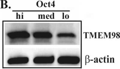 Western Blot: GPR64 Antibody [NBP1-84906]