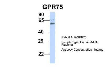 Western Blot: GPR75 Antibody [NBP1-59406]