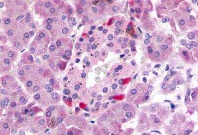 Immunohistochemistry-Paraffin: GPR81 Antibody - BSA Free [NLS2091]