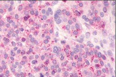 Immunohistochemistry-Paraffin: GPR81 Antibody - BSA Free [NLS2091]