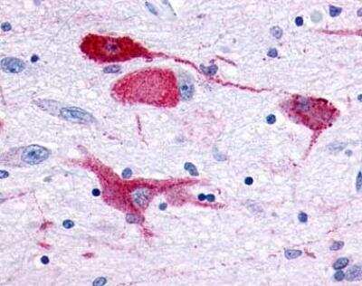 Immunohistochemistry-Paraffin: GPR83 Antibody - BSA Free [NLS4957]