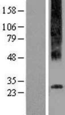 Western Blot: GPR97 Overexpression Lysate [NBP2-05207]