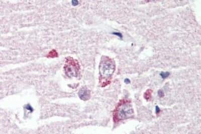 Immunohistochemistry-Paraffin: GPR98 Antibody [NBP3-14365]