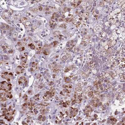 Immunohistochemistry-Paraffin: GPR98 Antibody [NBP2-57048]