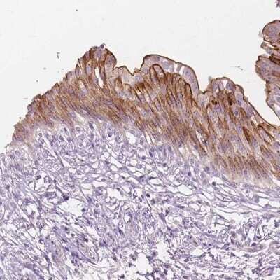 Immunohistochemistry-Paraffin: GPRC5A/RAI3 Antibody [NBP1-89743]
