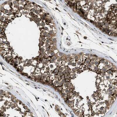 Immunohistochemistry-Paraffin: GPRC5B Antibody [NBP1-87160]