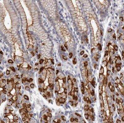 Immunohistochemistry-Paraffin: GPRC5C Antibody [NBP1-87159]