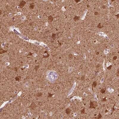 Immunohistochemistry-Paraffin: GPRIN1 Antibody [NBP2-57958]