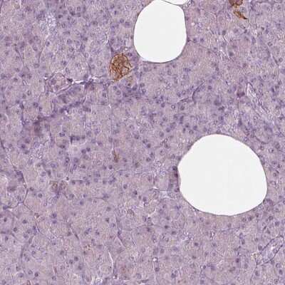 Immunohistochemistry-Paraffin: GPRIN1 Antibody [NBP2-57958]
