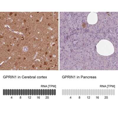 Immunohistochemistry-Paraffin: GPRIN1 Antibody [NBP2-57958]