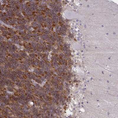 Immunohistochemistry-Paraffin: GPRIN3 Antibody [NBP2-33841]