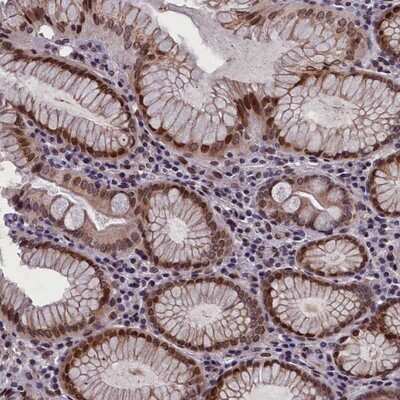 Immunohistochemistry-Paraffin: GPSM1 Antibody [NBP1-91968]