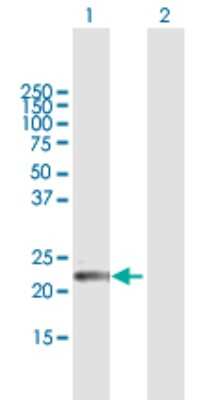 Western Blot: GPSM1 Antibody [H00026086-B01P]