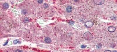 Immunohistochemistry: GPSM2 Antibody [NBP1-53125]