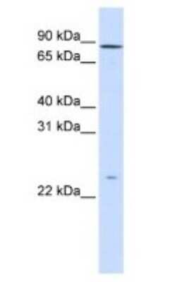 Western Blot: GPSM2 Antibody [NBP1-53125]