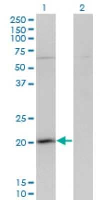 Western Blot: GPSM3 Antibody (1F11) [H00063940-M01]
