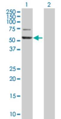 Western Blot: GPT Antibody [H00002875-D01P]