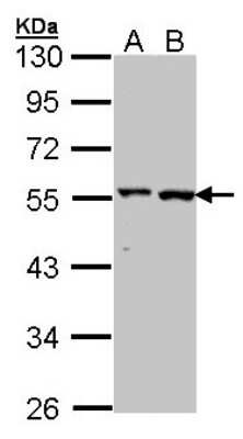Western Blot: GPT Antibody [NBP1-31525]