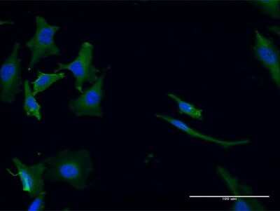 Immunocytochemistry/ Immunofluorescence: GPT2 Antibody (7A11) [H00084706-M04]