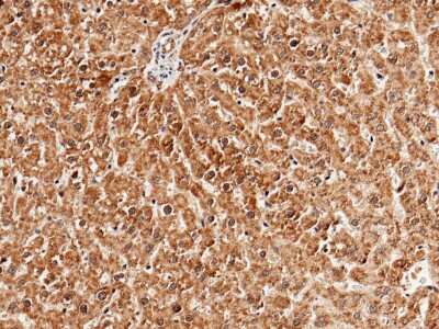 Immunohistochemistry-Paraffin: GPT2 Antibody [NBP2-98413]