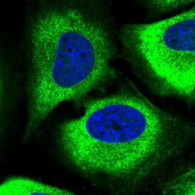 Immunocytochemistry/ Immunofluorescence: GPX8 Antibody [NBP2-48664]