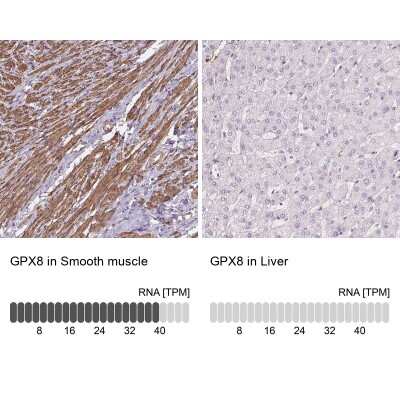 Immunohistochemistry-Paraffin: GPX8 Antibody [NBP2-48664]