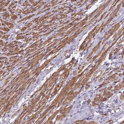 Immunohistochemistry-Paraffin: GPX8 Antibody [NBP2-48664]