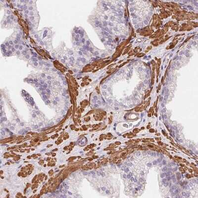 Immunohistochemistry-Paraffin: GPX8 Antibody [NBP2-48664]