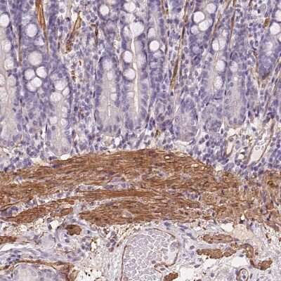 Immunohistochemistry-Paraffin: GPX8 Antibody [NBP2-48664]