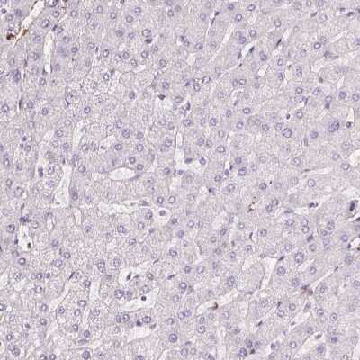 Immunohistochemistry-Paraffin: GPX8 Antibody [NBP2-48664]