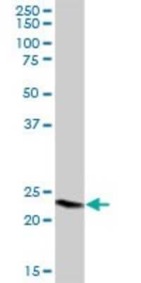 Western Blot: GPX8 Antibody [H00493869-B01P]
