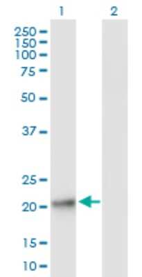 Western Blot: GPX8 Antibody [H00493869-B01P]