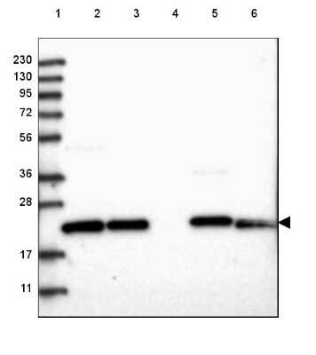 Western Blot: GPX8 Antibody [NBP2-48664]