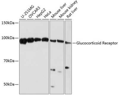 Western Blot: GR/NR3C1 Antibody (2K3E8) [NBP3-15789]