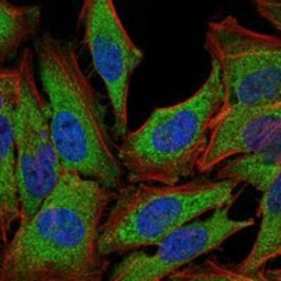 Immunocytochemistry/ Immunofluorescence: GR/NR3C1 Antibody (6E6) - BSA Free [NBP2-22174]