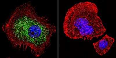 Immunocytochemistry/ Immunofluorescence: GR/NR3C1 Antibody (BuGR2) - BSA Free [NB300-731]
