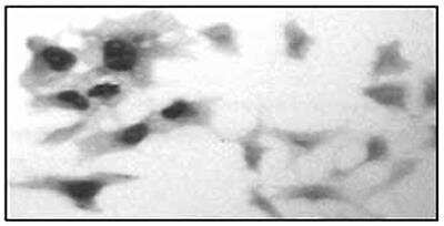Immunocytochemistry/ Immunofluorescence: GR/NR3C1 Antibody (C.15200010) [NBP2-59202]