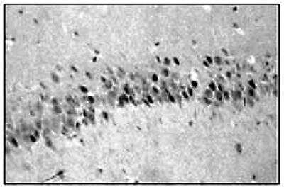 Immunohistochemistry: GR/NR3C1 Antibody (C.15200010) [NBP2-59202]