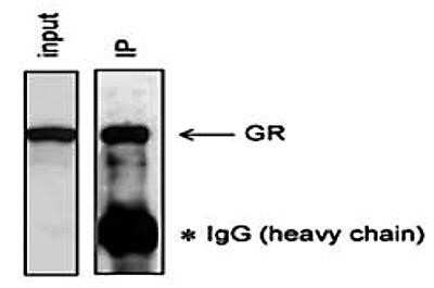 Immunoprecipitation: GR/NR3C1 Antibody (C.15200010) [NBP2-59202]