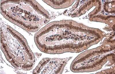 Immunohistochemistry-Paraffin: GR/NR3C1 Antibody (GT1073) [NBP3-13630]