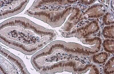 Immunohistochemistry-Paraffin: GR/NR3C1 Antibody (GT248) [NBP3-13626]