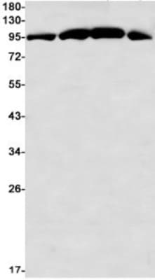 Western Blot: GR/NR3C1 Antibody (S02-5A3) [NBP3-19823]
