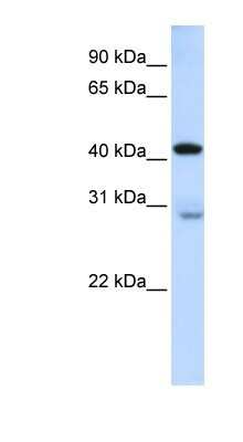 Western Blot: GRAMD2 Antibody [NBP1-80540]