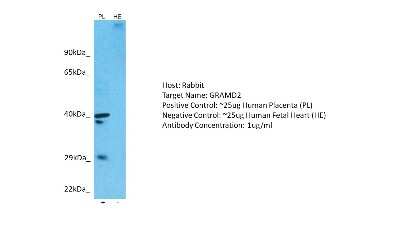 Western Blot: GRAMD2 Antibody [NBP1-80540]