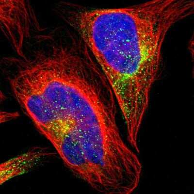Immunocytochemistry/ Immunofluorescence: GRAMD3 Antibody [NBP1-82149]